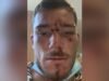 Conflicting claims as cops fight NRL star assault case