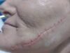 ‘Cackling’: psychotic attacker stabs woman in her bed