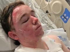 McDonald’s worker Jacob Smith suffers severe burns after coworker Jalani Bluett allegedly throws hot oil