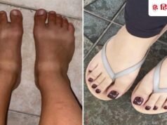 टैनिंग से काले हो गए हैं पैर? घर बैठे 3 स्टेप में करें पेडिक्योर, साफ-सुंदर और मुलायम हो जाएंगे!