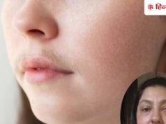 35 सालों से लगा रहीं ब्लीच! कॉस्मेटिक इंजीनियर ने बताया इस्तेमाल का सही तरीका