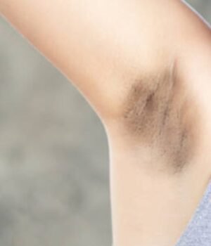 _dark_underarms_home_remedies_1783509985129_1783509985227_74b84773-b36f-4726-939d-17df09b622b2.jpg