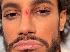 Frankie Grande suffers concussion after on stage accident in Titanique