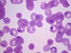 700 cases in 18 US states: What to know about the Cyclospora outbreak