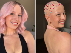 Alopecia advocate Holly Faller shares her 30-year journey to acceptance after wearing a wig since she was five