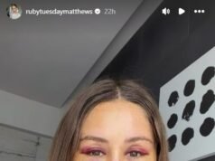 Ruby Tuesday Matthews: Influencer undergoes Korean facelift to achieve a more youthful look