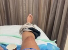 Amy Donohue: Australian woman seriously injured after Bali scooter accident