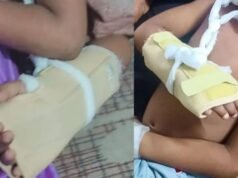 തിരൂരില് വീട്ടുമുറ്റത്ത് കളിക്കുകയായിരുന്ന നാല് വയസ്സുകാരനെ തെരുവുനായ കടിച്ചുകീറി