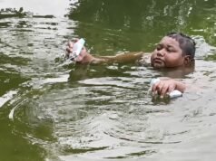 He stays in pond for hours, as coming out burns his skin. What is Aquagenic Pruritus?