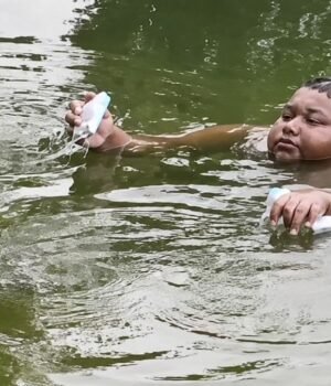 he-stays-in-a-pond-for-hours--as-coming-out-burns-his-skin-what-is-aquagenic-pruritus-image-x-100805566-16x9_0.png