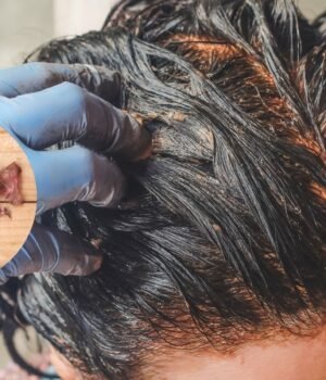 onion_peel_for_hair_1786357319348_1786357355900_a3dc5458-2a91-4515-b7db-aa56330f8880.jpg