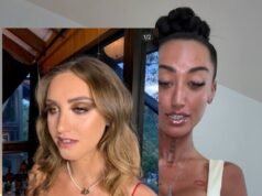 Matilda Baxter: Aussie influencer slams ‘Holocaust victim’ comparisons after spending $100,000 on surgeries