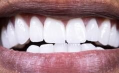 तोंडातील चांगले बॅक्टेरिया तुमच्या आरोग्यासाठी का महत्त्वाचे? त्यांना निरोगी ठेवण्यासाठी काय खाल?