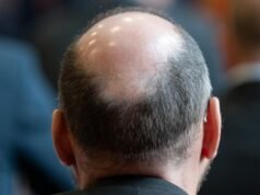 Hair loss jabs teased by Wegovy makers