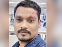 Jubilee Hills Police trace burglar through scar visible in CCTV