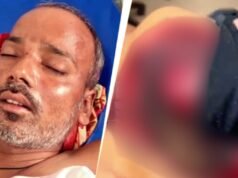 UP man ties friend to car, drags him 2.5 km after dispute