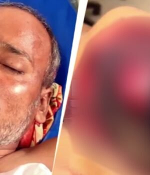 bablu-rathore--who-was-allegedly-dragged-behind-a-car-for-nearly-25-km-in-hardoi--uttar-pradesh-205251355-16x9_0.jpg