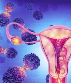 silent_symptoms_of_ovarian_cancer_1790304731048_NRr1_1790304731206_O0QM_306dadd8-bd75-4868-9563-34538a6e1c02_O1kh.jpg