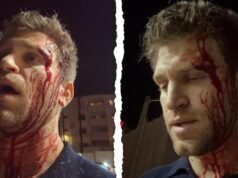 Keegan Allen: Pretty Little Liars actor shares bloody video after allegedly being robbed by armed attackers