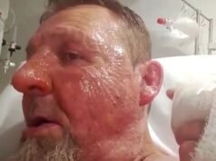 Prince of Wales Hospital patient charged after alleged fire attack injures three in Randwick