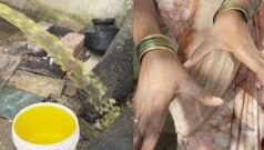 ‘बाळ होऊ देऊ नका,’ प्रदूषित पाण्यामुळे त्वचेच्या समस्येवर उपचार घेणाऱ्या महिलेला डॉक्टरांचा सल्ला