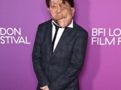 Adam Pearson hails positive disability representation progress in film industry