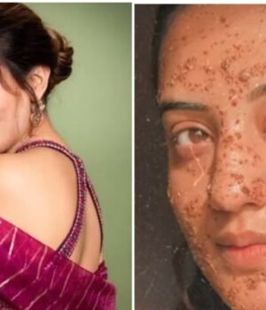 akshara_singh_skin_care_routine_1791977011199_F2jQ_1791977011456_voSi_5d23f9e5-0e81-4725-895e-c0e3b3c26e75_EOiY.jpg