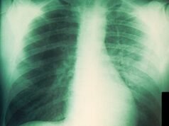 Russian plague: Lab worker dies from pneumonic illness as 200 people put into observation