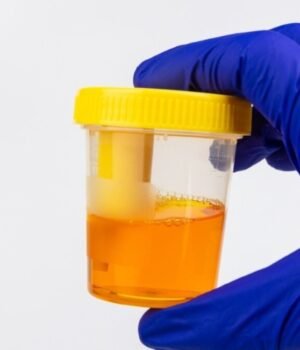 doctor_explains_Foamy_urine_causes_1790855175360_QDx9_1790855175523_0qax_3d32f5d0-63e6-4f67-92d2-7be27a4e5bc9_8GbO.jpg