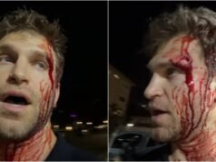 Pretty Little Liars actor Keegan Allen robbed at gunpoint, assaulted in Los Angeles